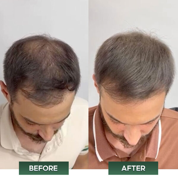 alika hair products review - fb1